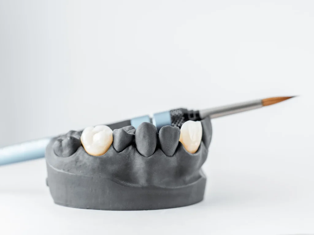 jaw model to display dental crowns Brentwood, TN