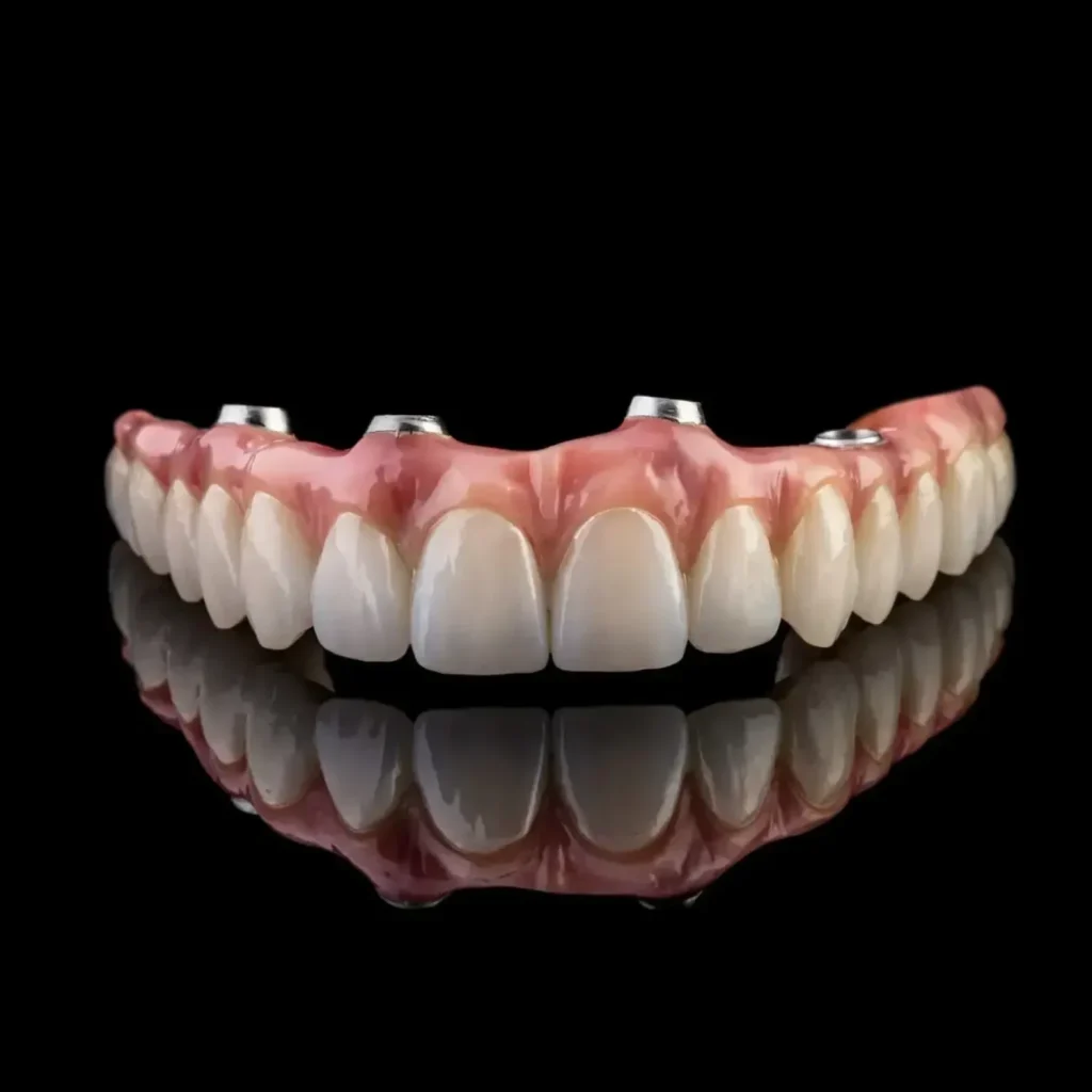 Photo of an all on 4 upper implant bridge